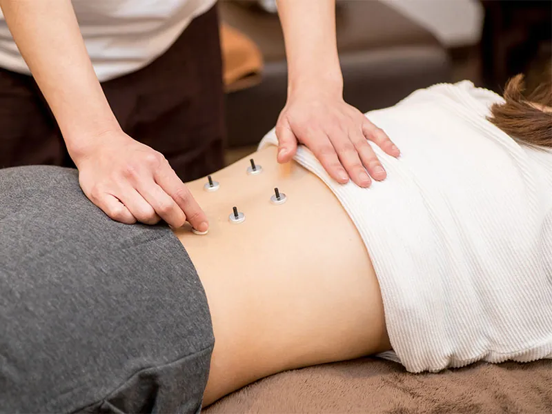 鍼灸治療室の風景